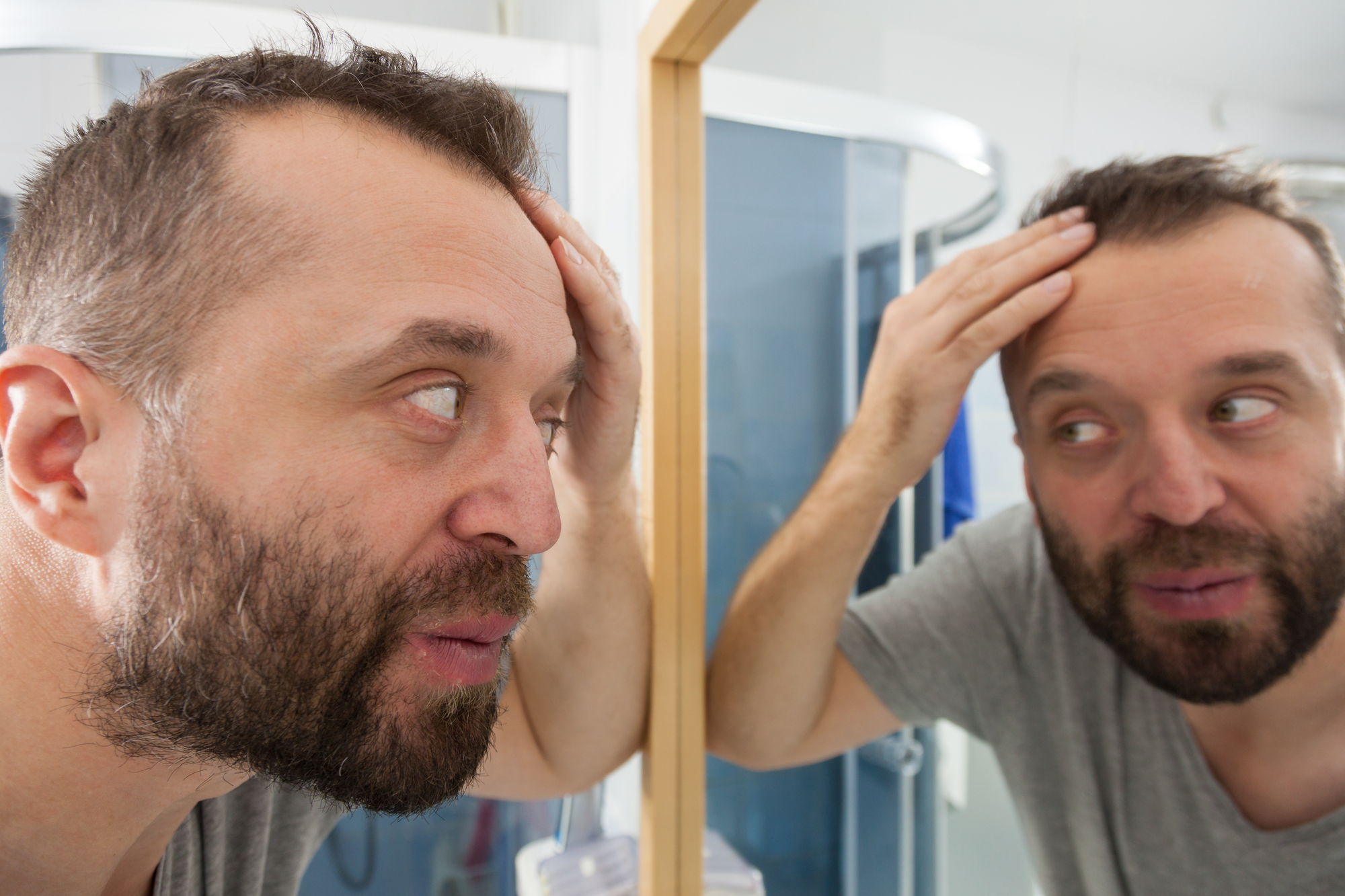 A man with a beard and short hair examines his reflection closely in a bathroom mirror, looking concerned. He is holding his head with both hands, focusing on the top of his head. The bathroom features a modern shower enclosure in the background.