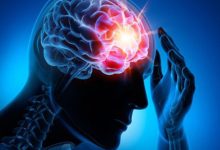 چگونه می‌توان خطر بروز سکته مغزی را کاهش داد؟