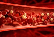 آیا کلسترول خون پایین به معنای سالم بودن قلب است؟