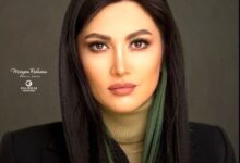 تغییر چهره عجیب سمیرا حسینی | خانم بازیگر با چهره جدید جنجالی شد