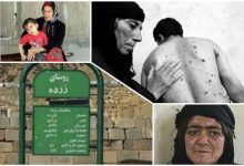 روایتی از بمباران شیمیایی هیروشیمای ایران