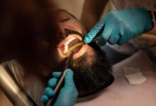 GERD و دندان های شما: علائم، درمان و پیشگیری
